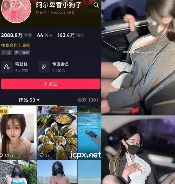 抖音网红 阿尔卑香小狗子 微密圈图片&amp;视频 全套资源合集[持续更新]