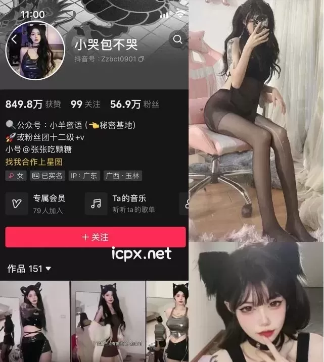 反差网红@小哭包不哭 微密圈全套作品合集资源[持续更新]