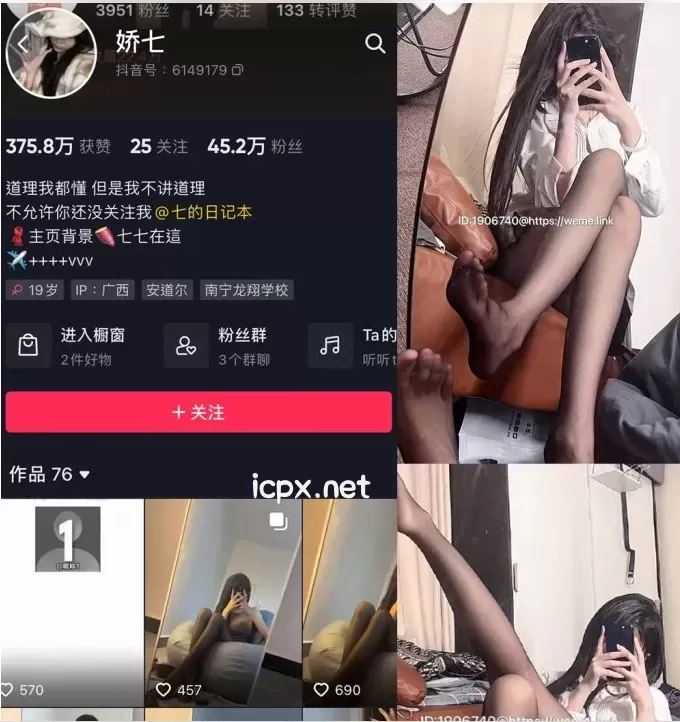 娇七 微密圈全套作品合集只要[14套]最新作品