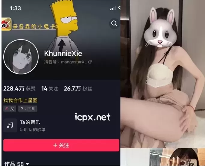 辛普森的兔子 微密圈合集资源[持续更新至59套]6月最新