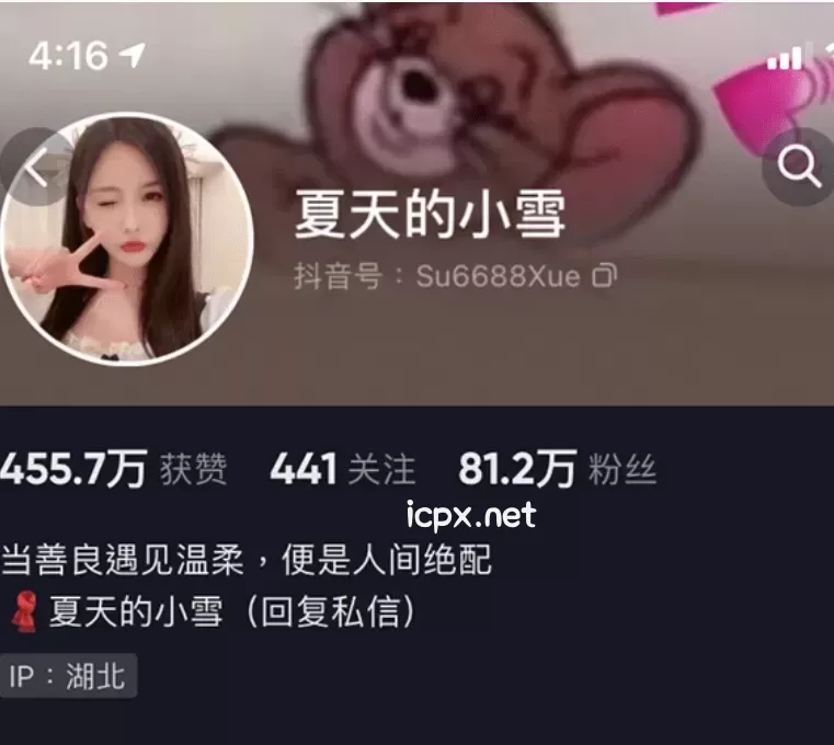 [持续更新] 夏天的小雪 微密圈付费图片&amp;视频 资源合集18期