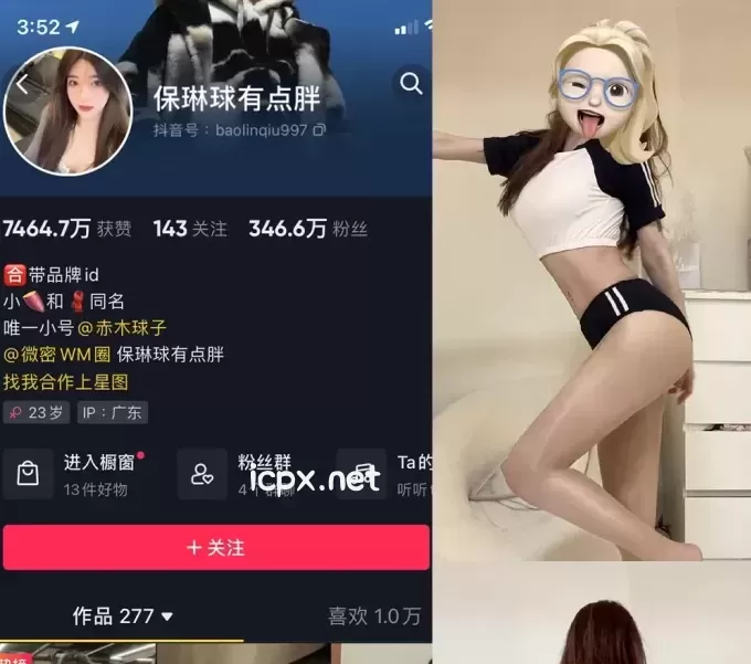 [抖音]保琳球有点胖-微密圈付费入圈作品合集[30套]